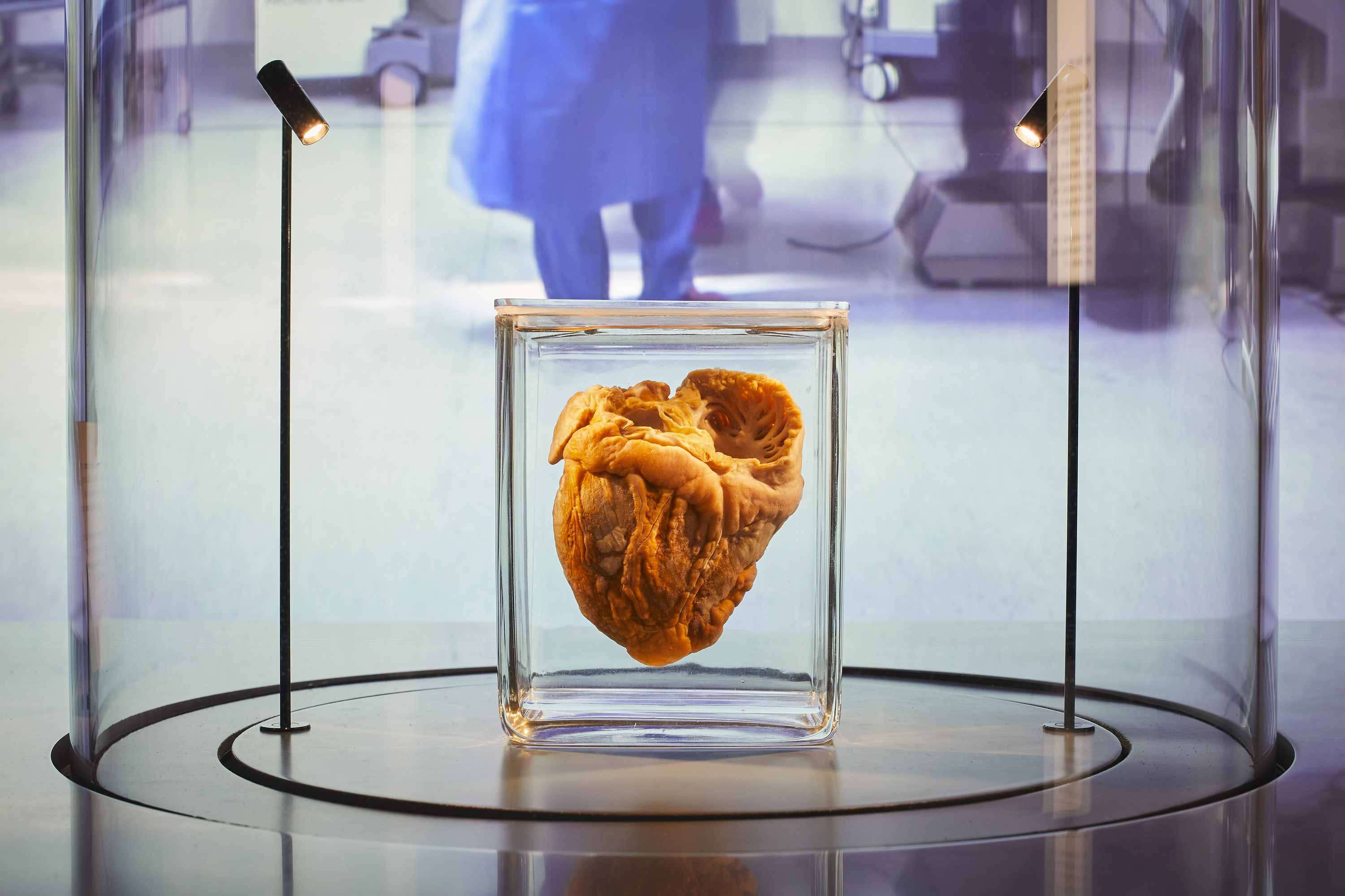 Hunterian Museum fascinating collection of medical specimens and