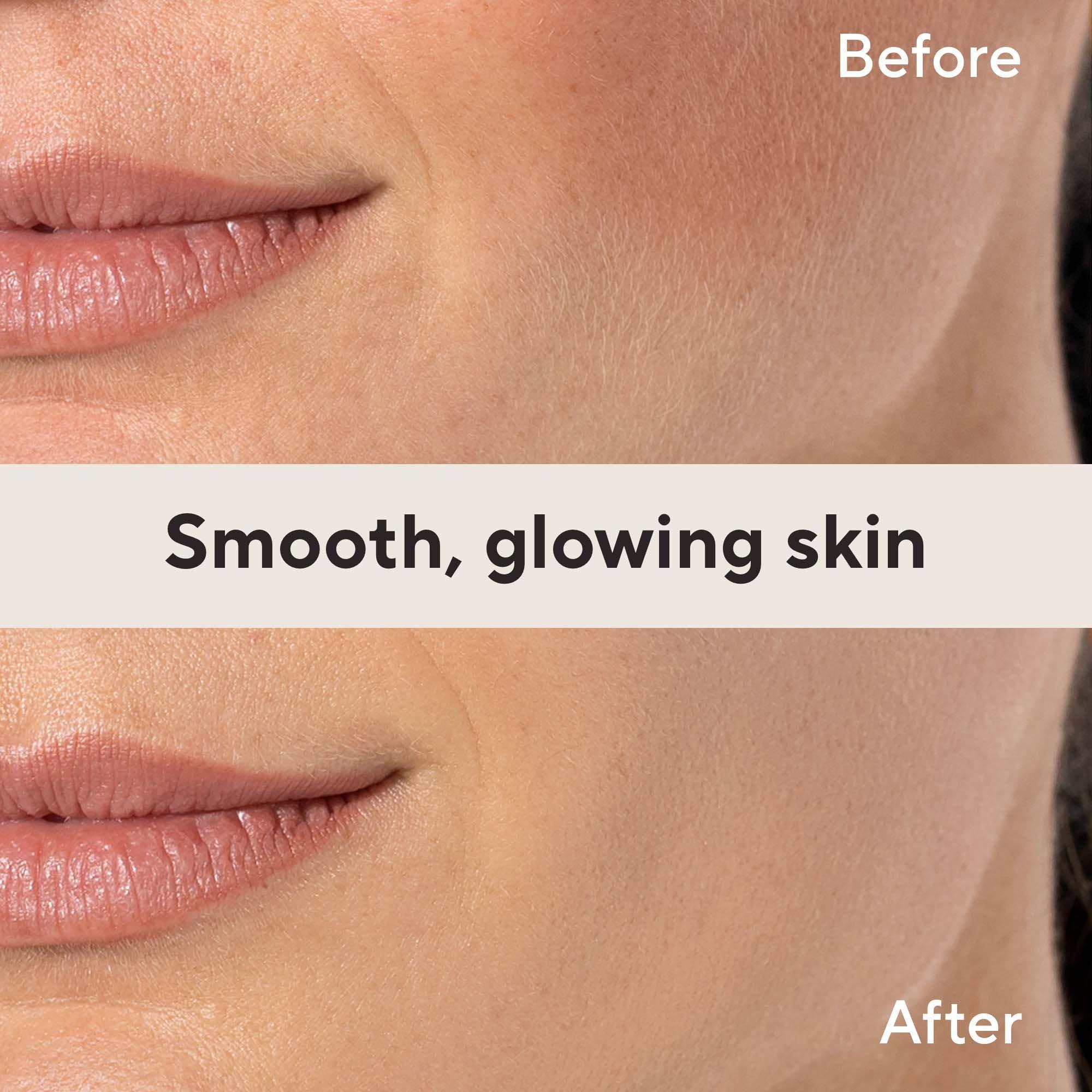 Flawless By Finishing Touch Flawless Dermaplane Facial Exfoliator And