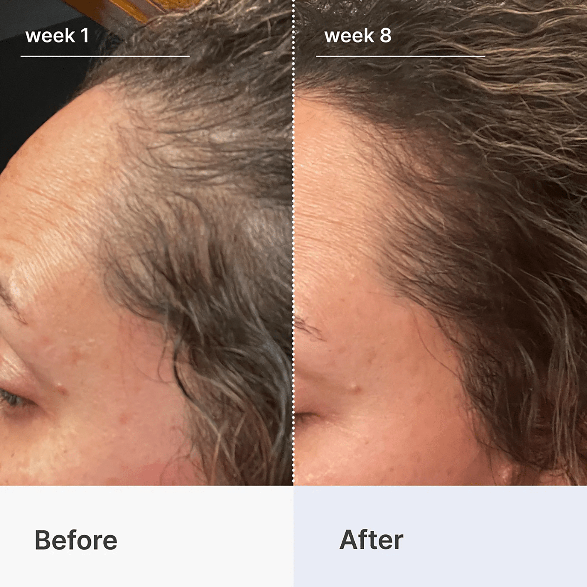 Better Not Younger Superpower+ Advanced Hair Densifying Scalp Serum International Shipping