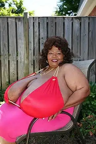 Meet Norma Stitz: The Woman with the World's Largest Breasts