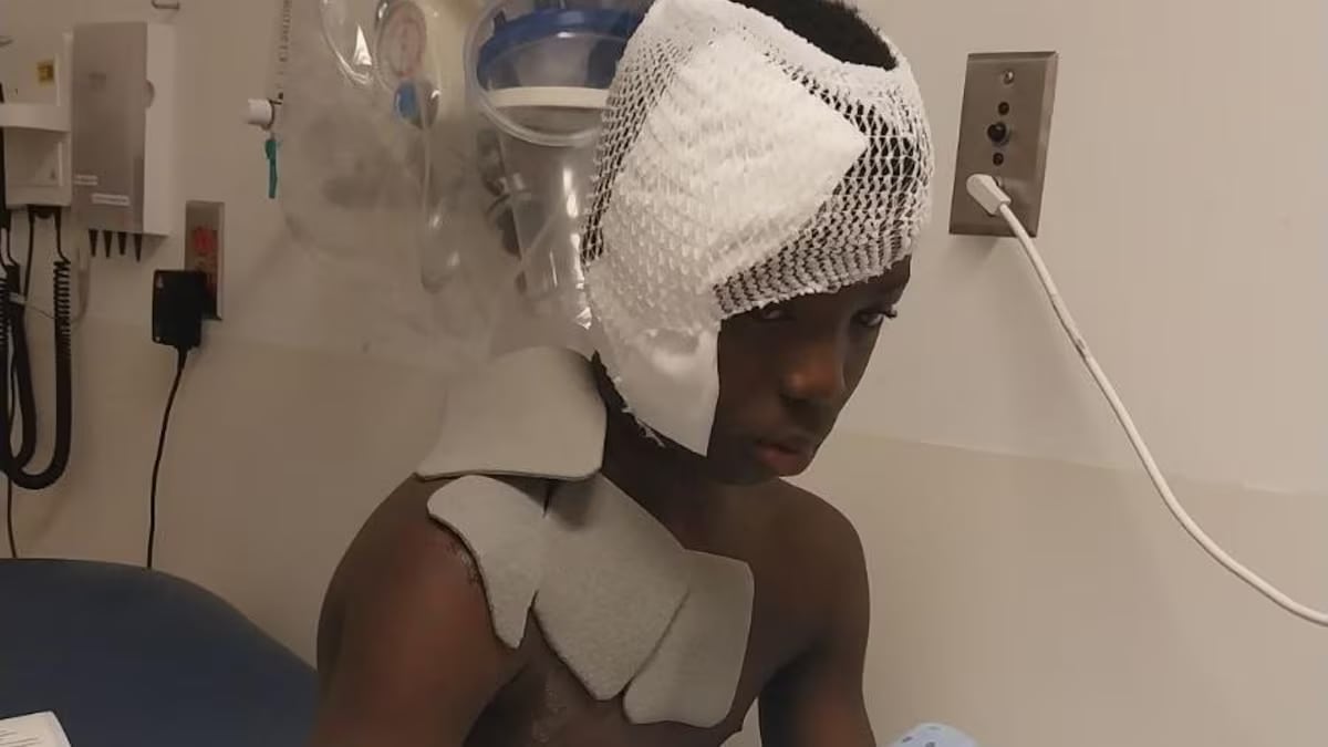 Montrealarea boy severely burned after stranger throws boiling water on him