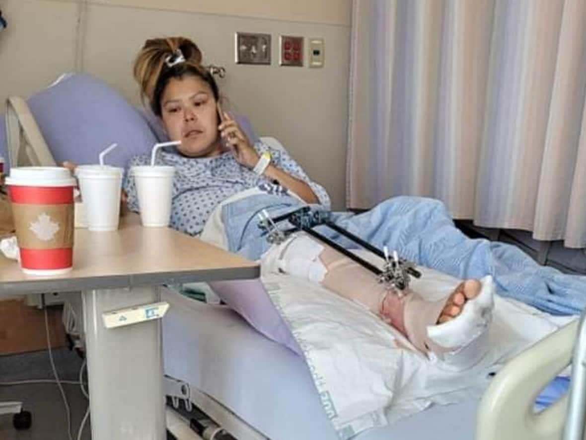 B.C. woman claims RCMP broke her leg and left her suffering overnight