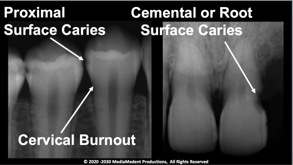 Praised, Essential Radiology for Dental Students & Practitioners2023