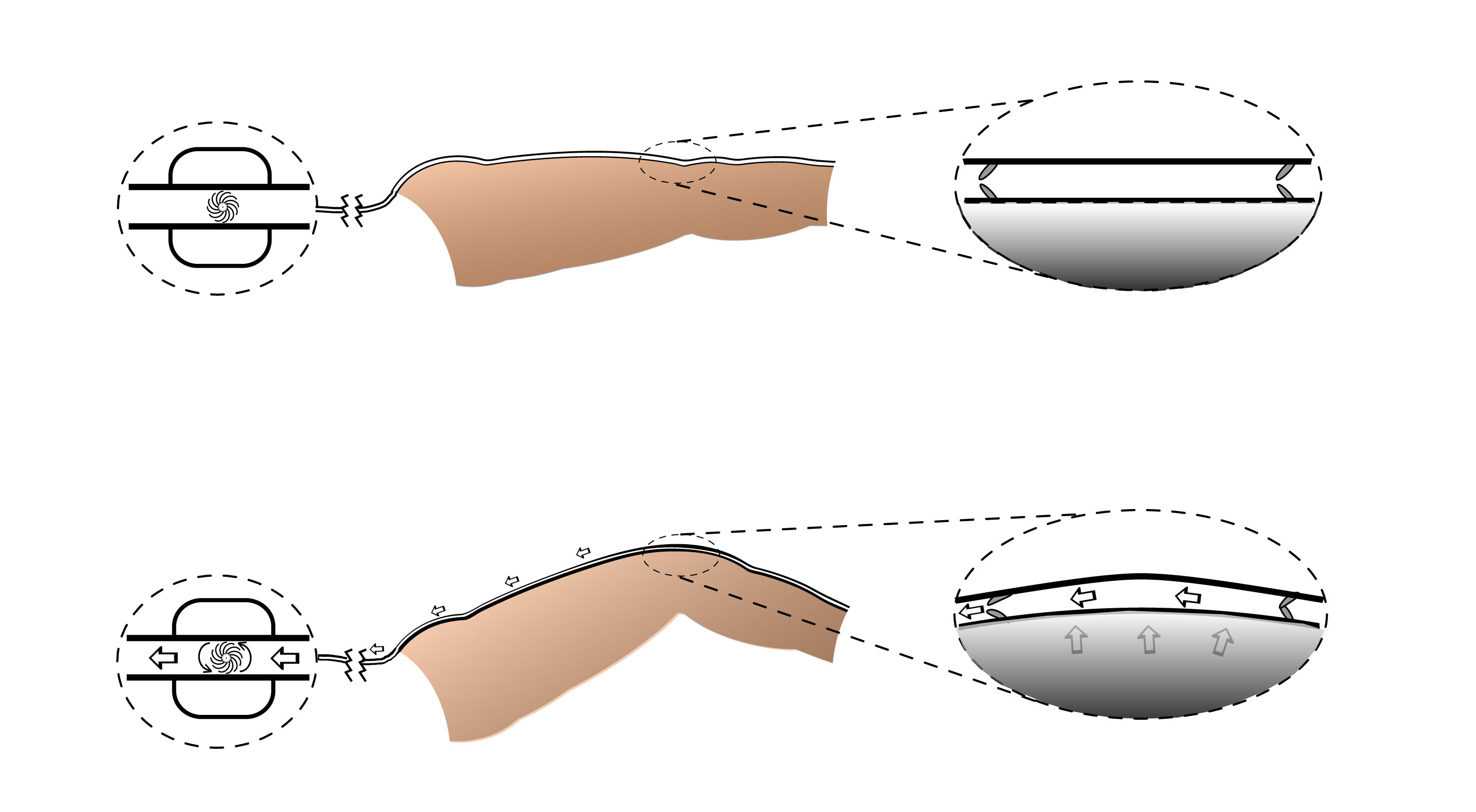 Medibotics Electricity Generating Clothing