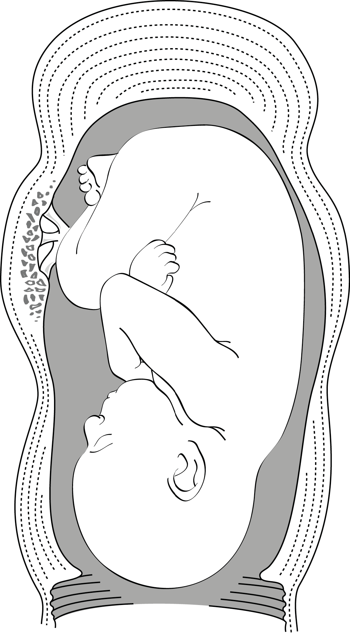 hond vervagen hack Wennen aan zo Vooroordeel ring van bandl