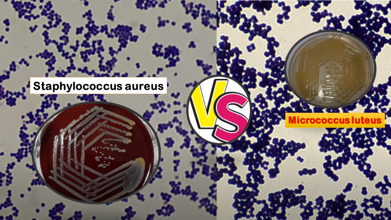 Staphylococcus aureus and Coagulase Negative Staphylococci (CoNS