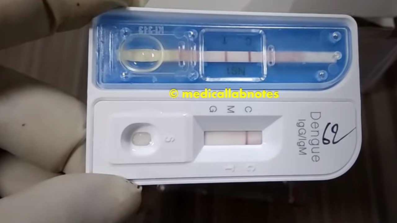 Dengue Rapid Test for IgG and IgM Detection Introduction, Princi