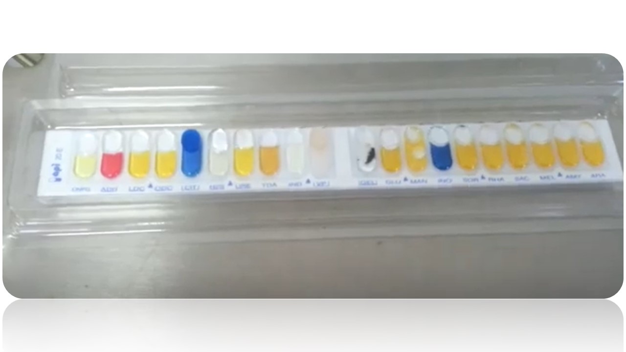 API Test for Bacteria Introduction, Principle,Test Requirements