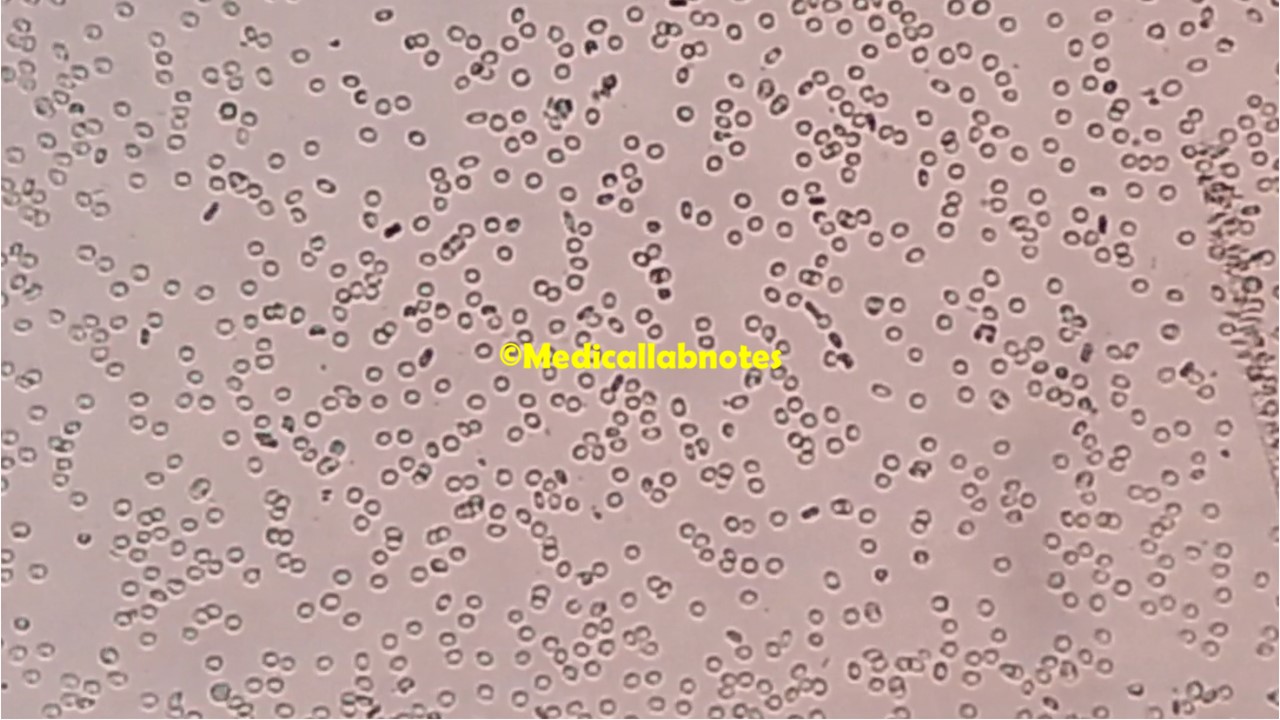 Indirect Coomb Test (ICT) Introduction, Principle, Test Requirement