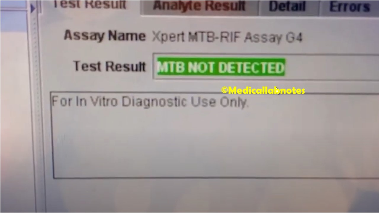 GeneXpert Test For Tuberculosis Introduction, Principle, Test