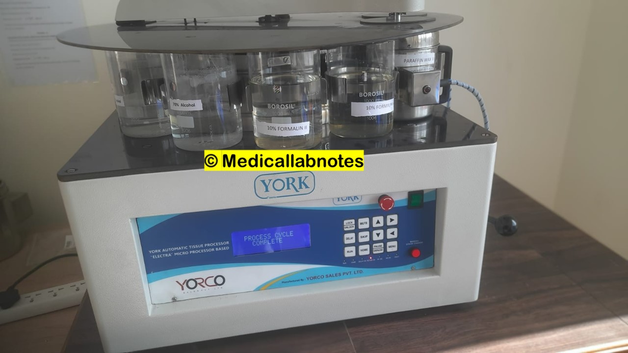 Automatic Tissue Processor Introduction, Principle, Types, Hand