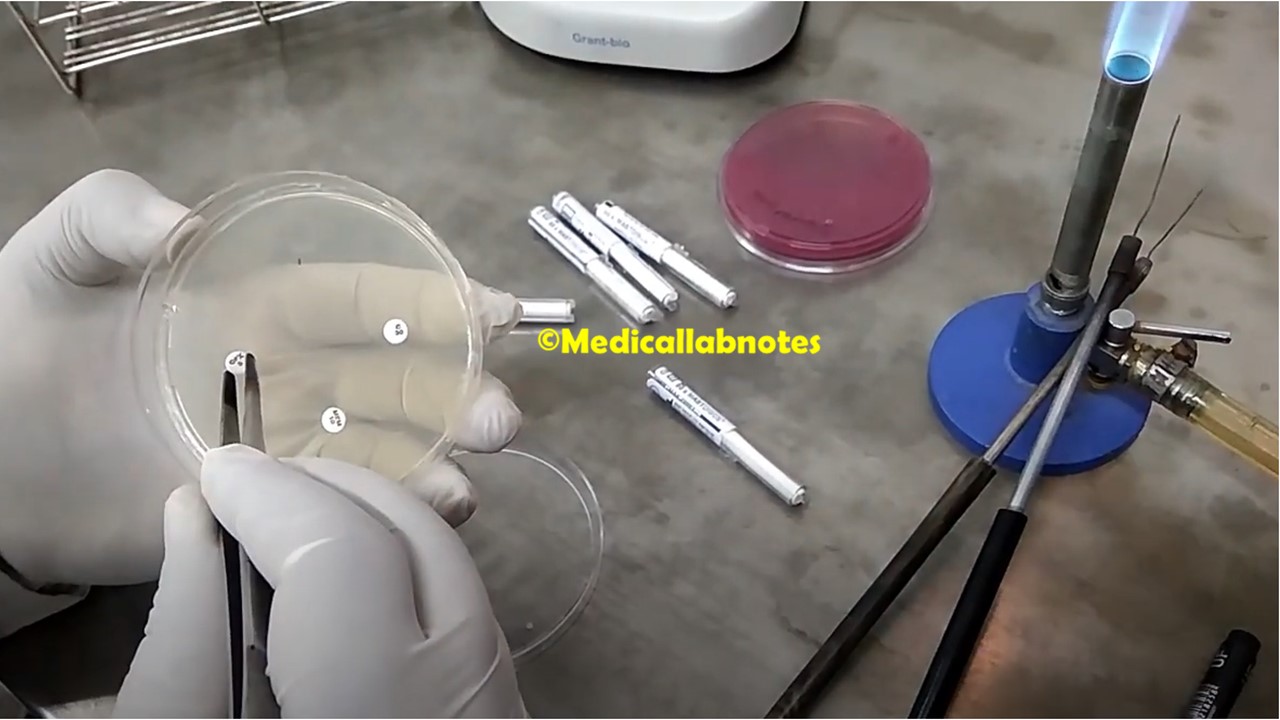 AST (Antimicrobial Susceptibility Testing) Archives Medical Notes