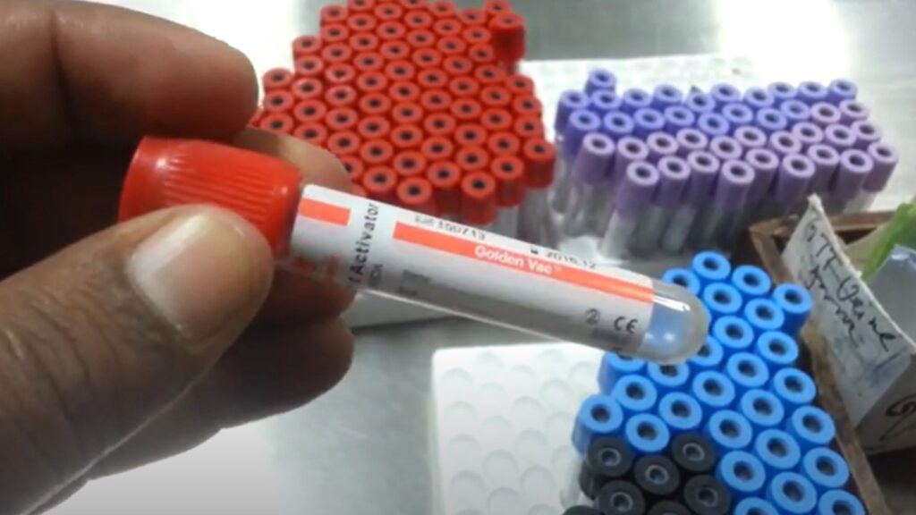 Lead Blood TestIntroduction, Test Result, Unit, Reference Range