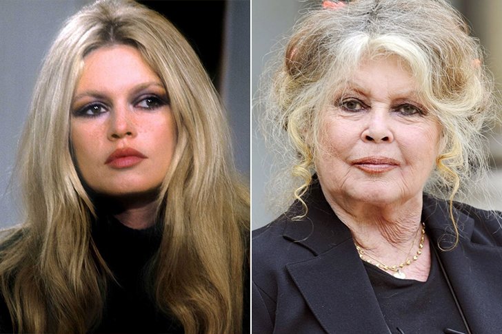Frozen In Time For These Celebrities Time Had An