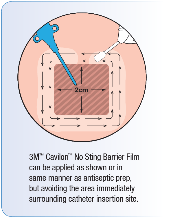 Cavilon No Sting Barrier Film Products Medical Monks