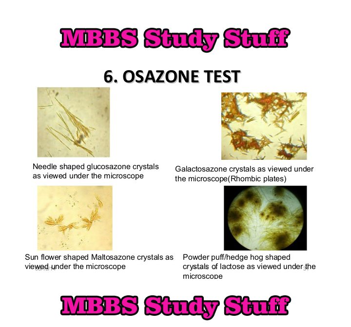 OSAZONE TEST Medical Study Zone