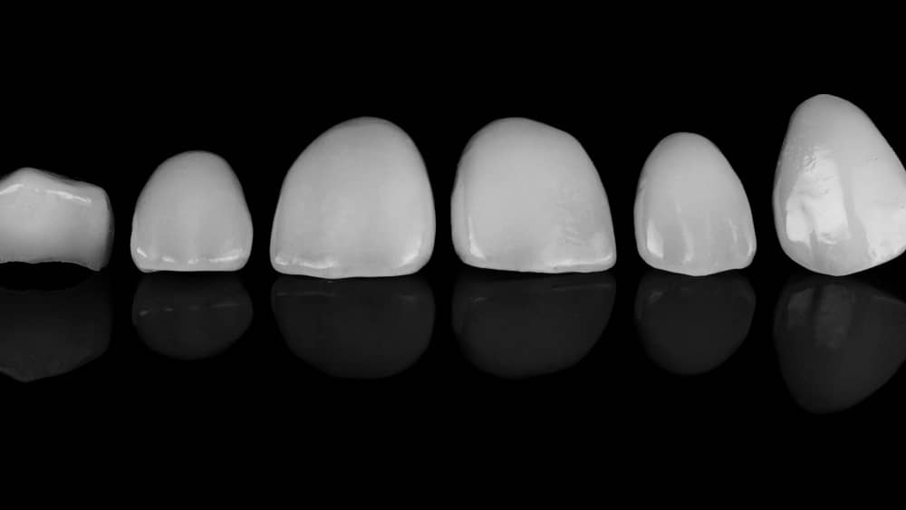 How much does a full set of veneers cost in Turkey? Dental Centre In