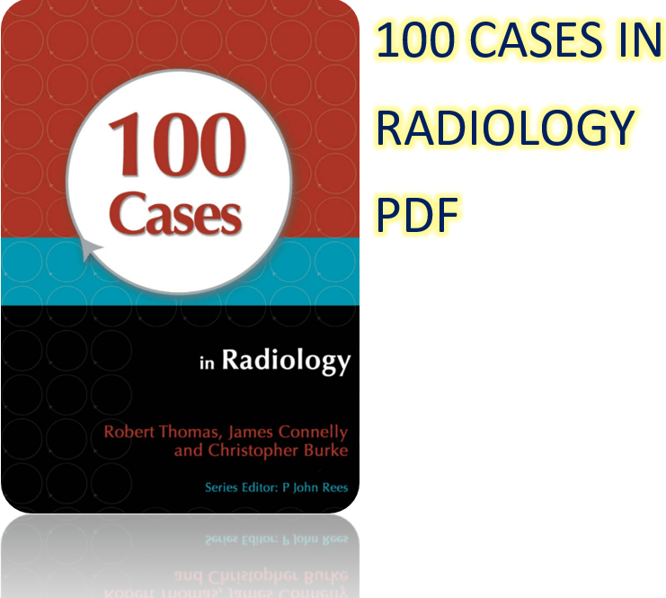 100 Cases in Radiology PDF Download Free2021 Medical Students Corner