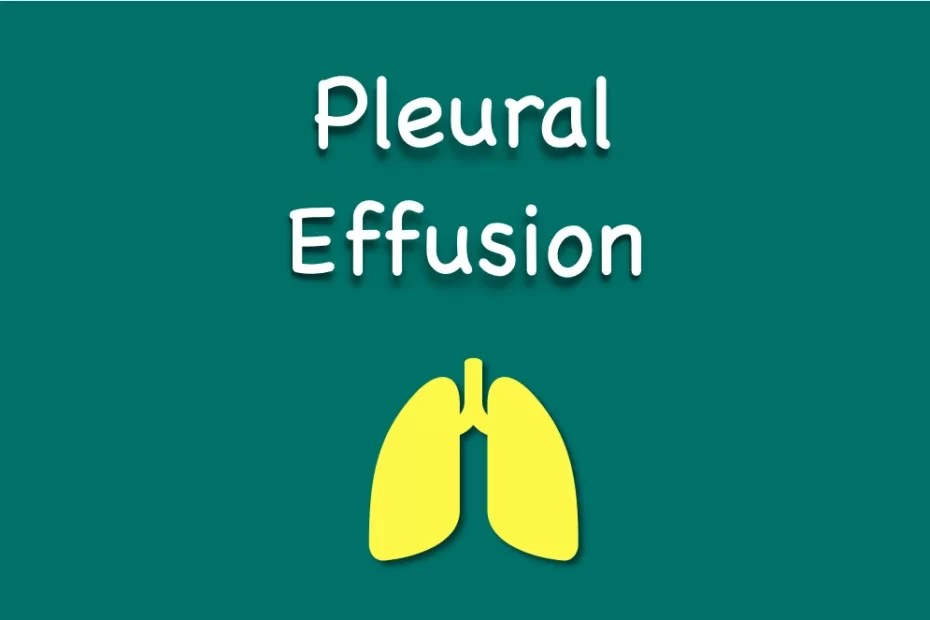 What is Pleural effusion Causes, Pathology, Treatment MediGac