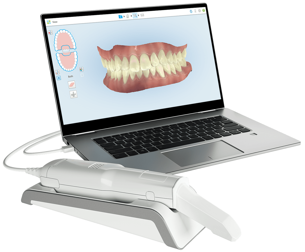 iTero Element MediMatch Dental Laboratory