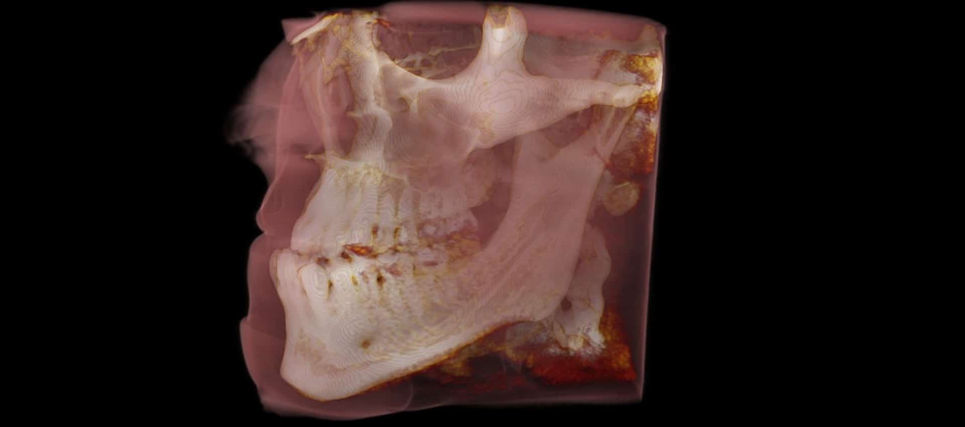 Convert a file to a 3d model file process Medimodel