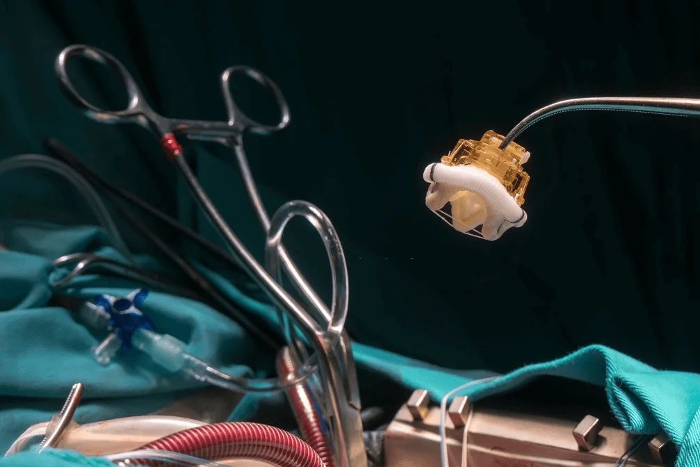 Heart Valve Replacement Surgery Cost in India Medinirvana