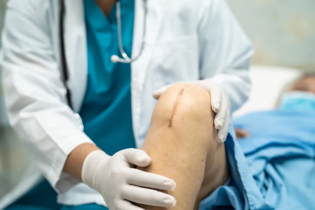 Knee Replacement Surgery Cost/Surgeon/Hospital in India, Success Rate?