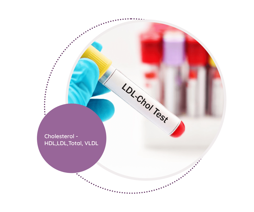 Cholesterol MediScan Lab
