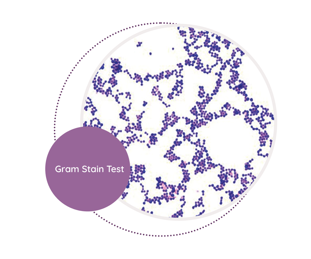 Gram Stain Test MediScan Lab