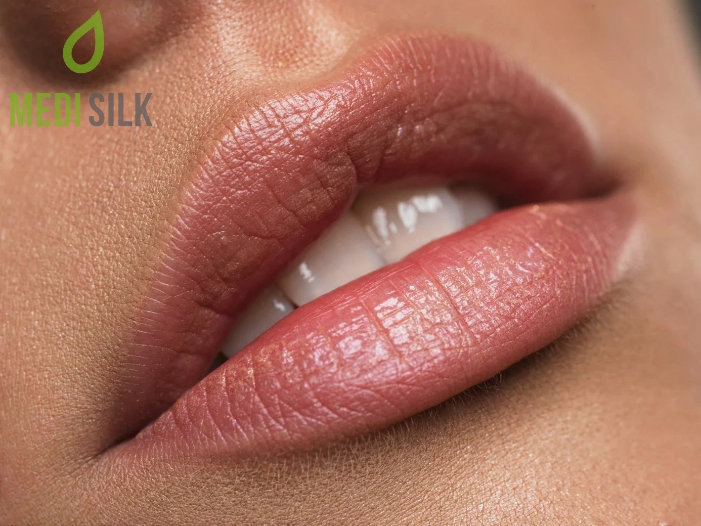 How Much Do Lip Injections Cost? • Medisilk