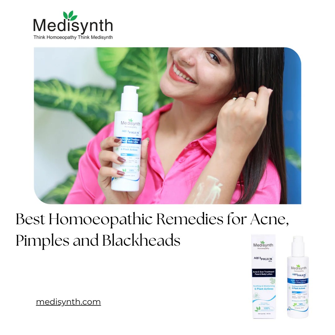 Best Homoeopathic Remedies for Acne, Pimples and Blackheads Medisynth