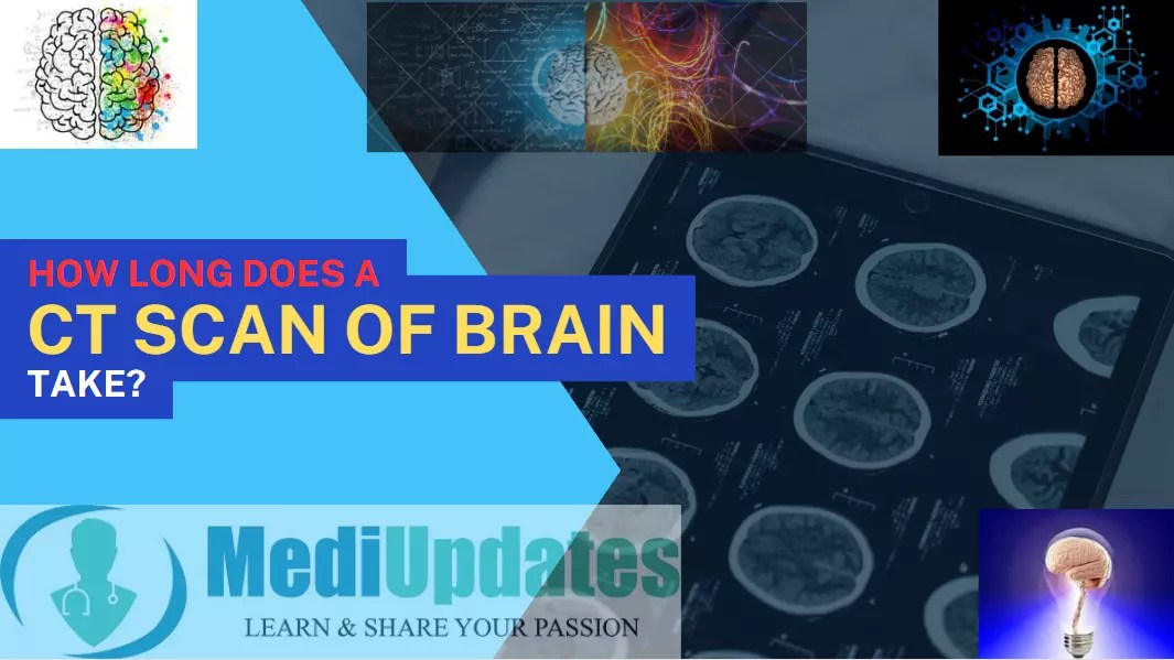 How Long Does a CT Scan of the Brain Take? A Comprehensive Guide