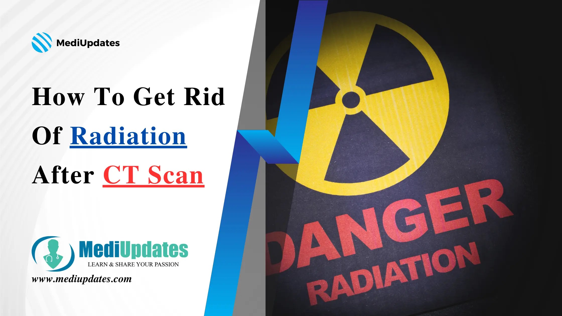 How To Get Rid Of Radiation After CT Scan MediUpdates