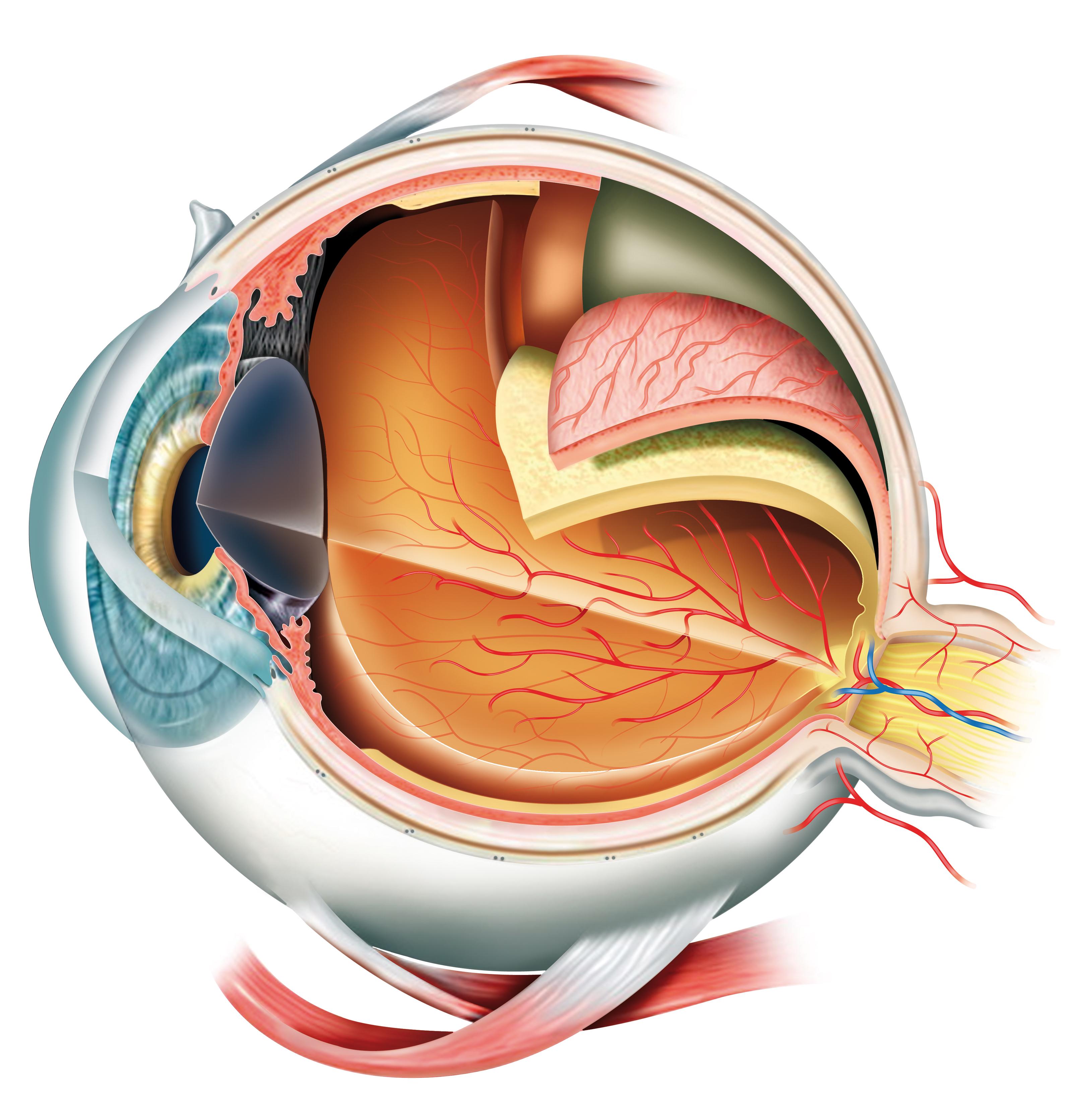 Eye Cancer Retinoblastoma MedlinePlus