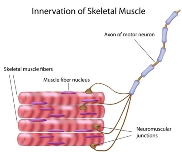 Distal hereditary motor neuropathy, type II MedlinePlus