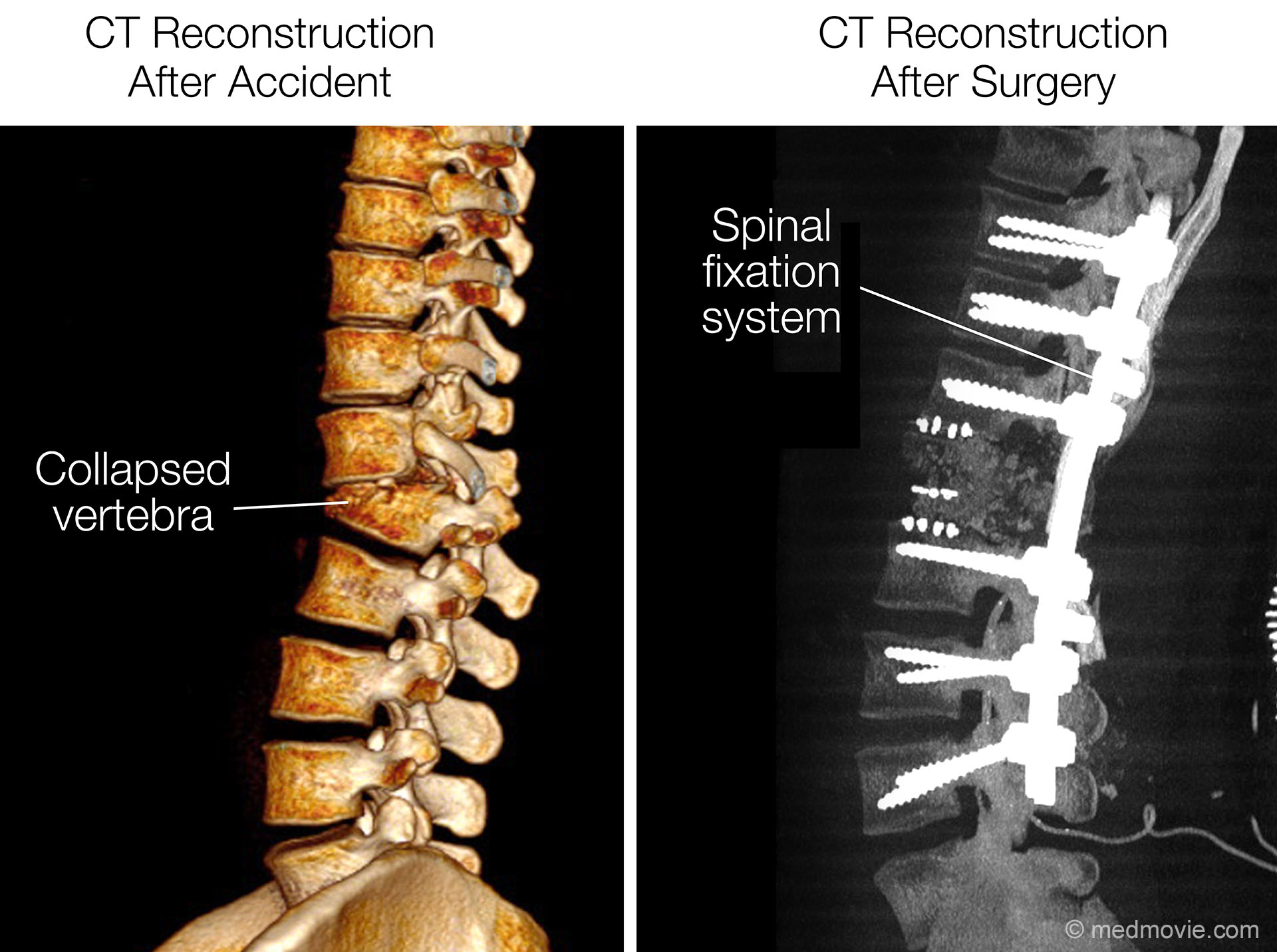 Creating 3D Medical Reconstructions for Mediation and Trial