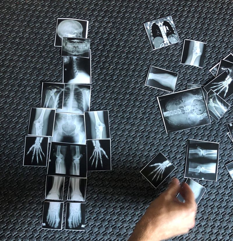 Madison Explorers Summer Camp (1/3) Department of Medical Physics