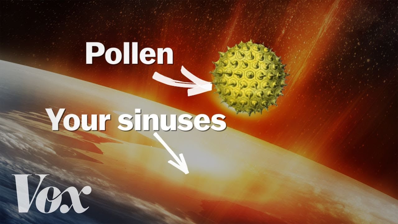 Why your allergies get worse every year MED PODD