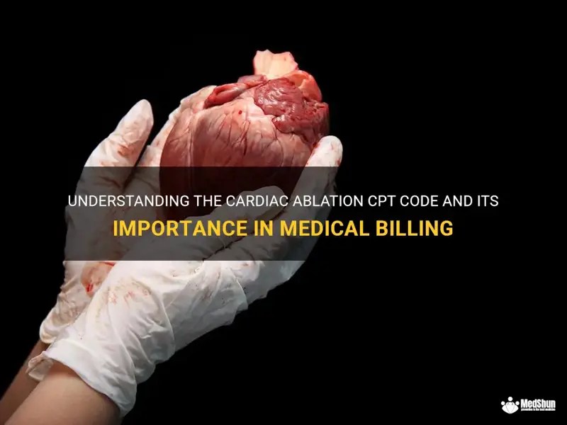 Understanding The Cardiac Ablation Cpt Code And Its Importance In