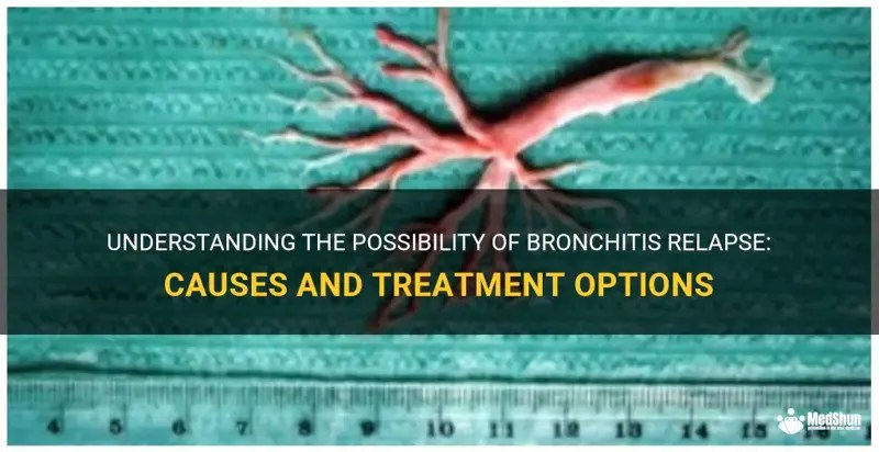 Understanding The Possibility Of Bronchitis Relapse Causes And