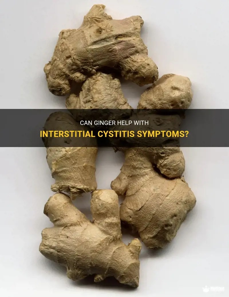 Can Ginger Help With Interstitial Cystitis Symptoms? MedShun