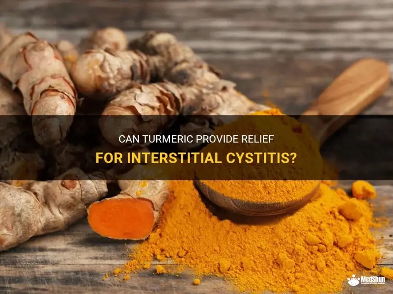 Can Turmeric Provide Relief For Interstitial Cystitis? MedShun