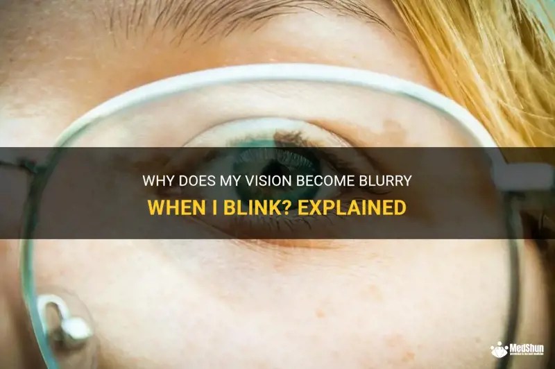 Why Does My Vision Blurry When I Blink? Explained MedShun