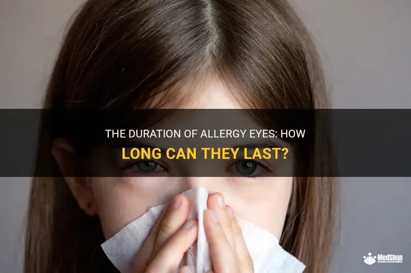 The Duration Of Allergy Eyes How Long Can They Last? MedShun