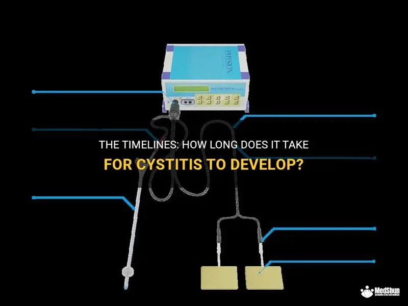The Timelines How Long Does It Take For Cystitis To Develop? MedShun