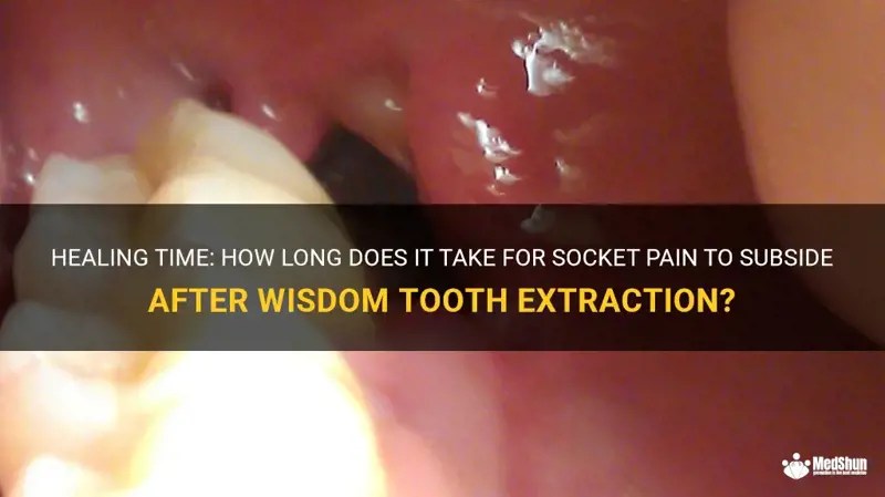 Healing Time How Long Does It Take For Socket Pain To Subside After