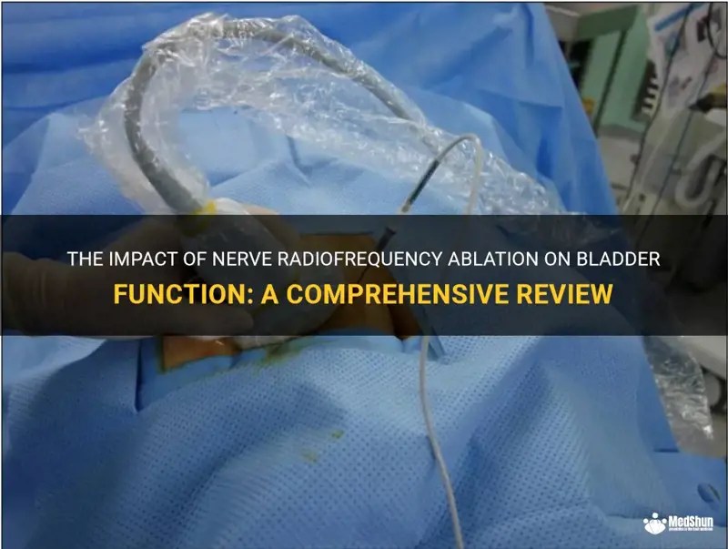 The Impact Of Nerve Radiofrequency Ablation On Bladder Function A