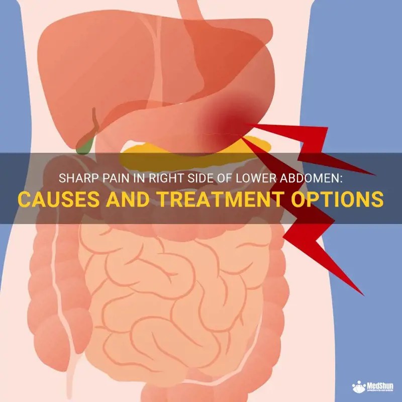 Sharp Pain In Right Side Of Lower Abdomen Causes And Treatment Options
