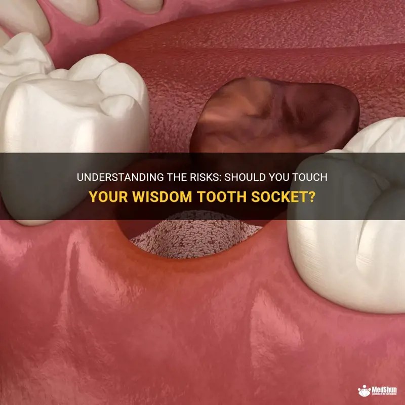 Understanding The Risks Should You Touch Your Wisdom Tooth Socket