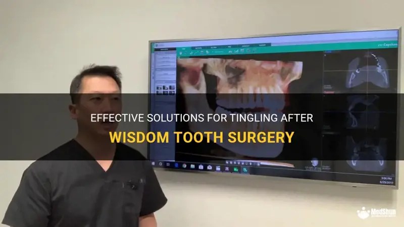 Effective Solutions For Tingling After Wisdom Tooth Surgery MedShun